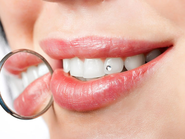 Dental jewelry adalah perhiasan kecil yang ditempatkan di gigi pasien sebagai aksesori dekoratif. Perhiasan ini biasanya terbuat dari bahan seperti emas putih, perak, atau kristal berlian imitasi dan ditempatkan di atas permukaan gigi menggunakan perekat khusus