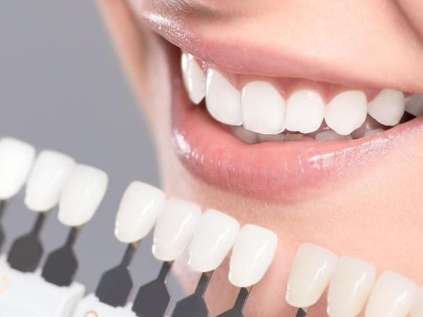 Veneer adalah lapisan porselen atau resin komposit yang ditempatkan di atas permukaan gigi untuk membantu menyamarkan noda gigi, merapikan gigi yang bergeser, memperbaiki gigi yang pecah/rusak dan bentuk gigi yang tidak simetris.